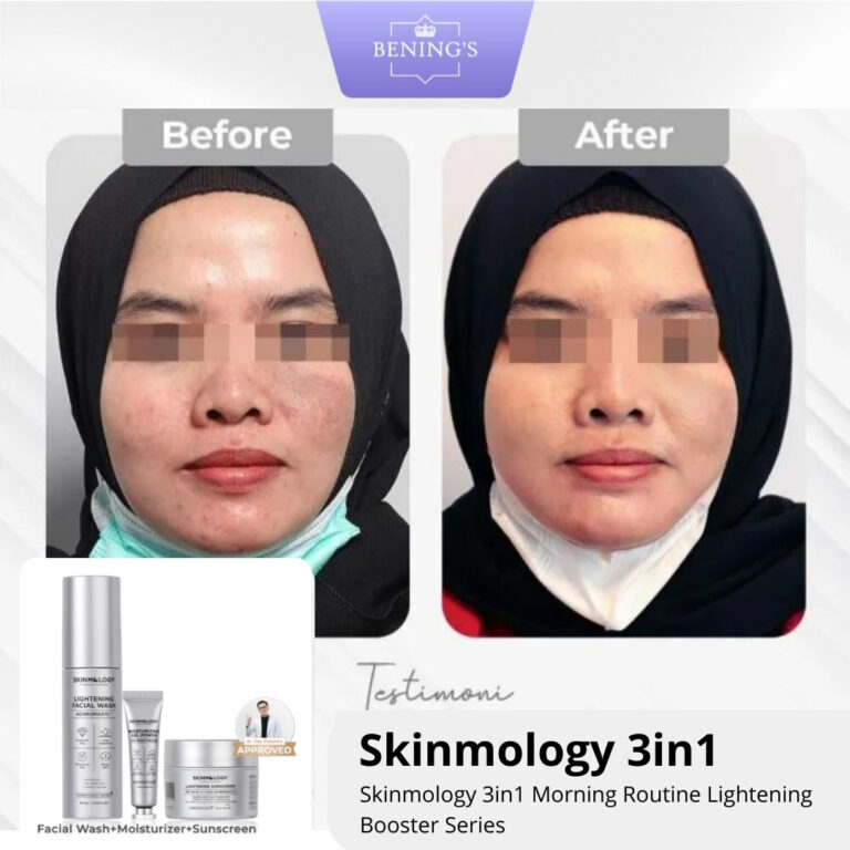 Testimoni Paket Skinomologi 2