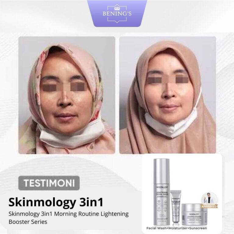 Testimoni Paket Skinomologi